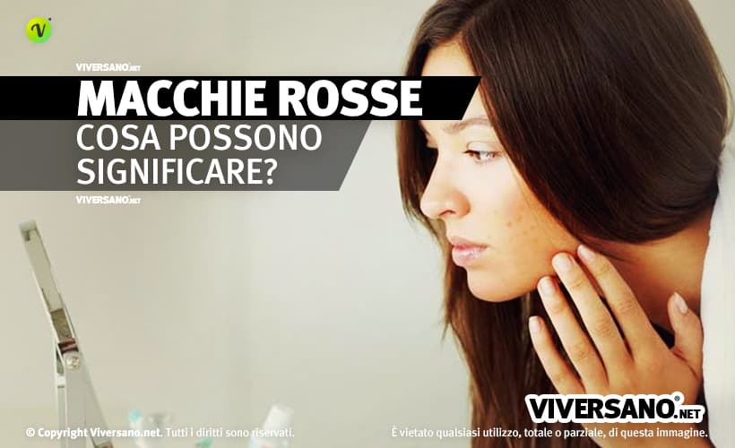 Donna con macchie rosse sulla pelle