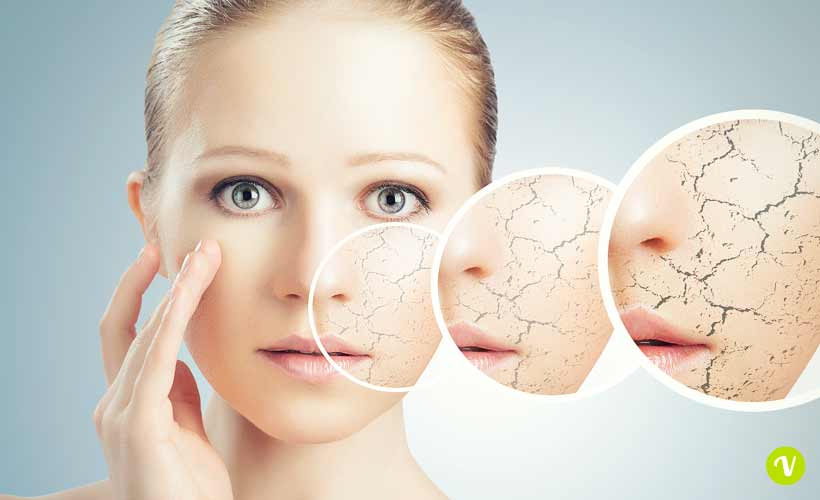 rimedi naturali per pelle secca