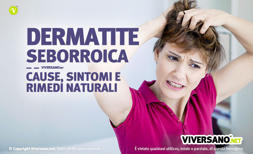 Immagine di donna con forte prurito alla testa a causa della dermatite seborroica