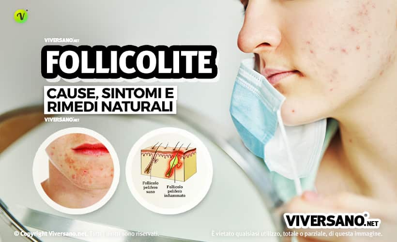 Soggetto con follicolite batterica