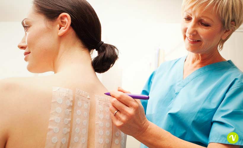 Allergia al nichel: sintomi e cause