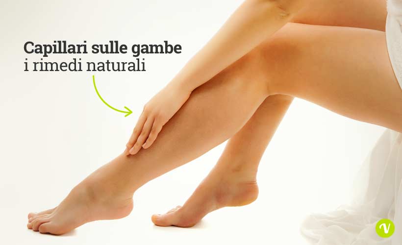 Capillari sulle gambe: i rimedi naturali