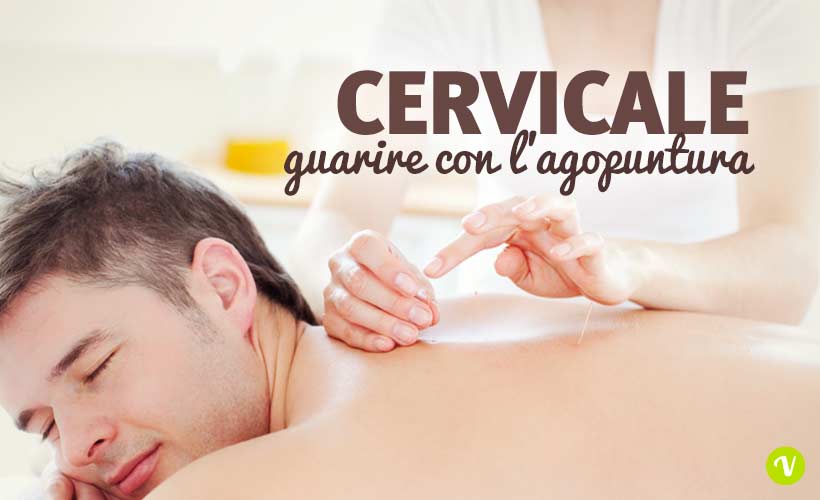 Cervicale e agopuntura