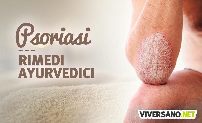 Rimedi ayurvedici contro la psoriasi