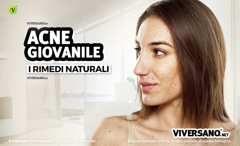 Ragazza con acne giovanile sul viso