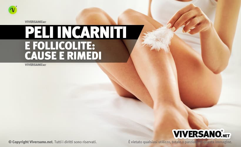 Come eliminare i peli incarniti con rimedi naturali