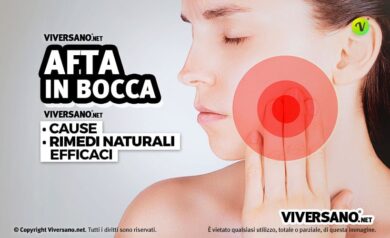 Afte in bocca: cause, sintomi e rimedi naturali
