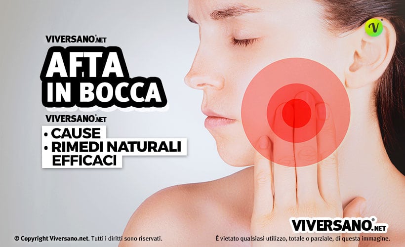 Afte in bocca: cause, sintomi e rimedi naturali