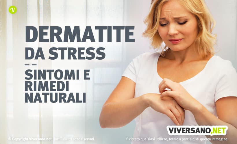 Dermatite da stress: cause sintomi e rimedi naturali