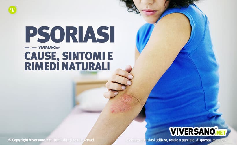 Immagine di donna con psoriasi al gomito