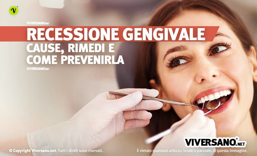 Donna con recessione gengivale dal dentista