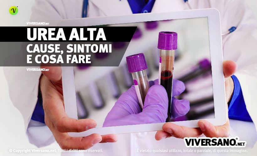 Urea alta nel sangue