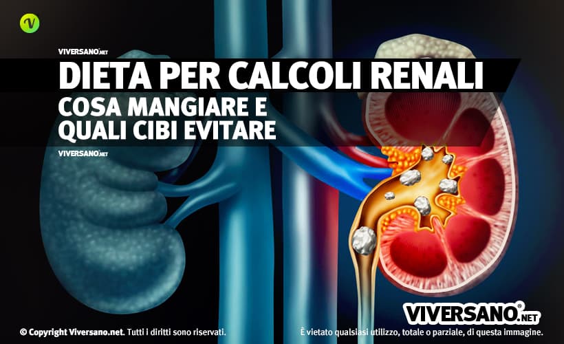 Dieta per calcoli renali