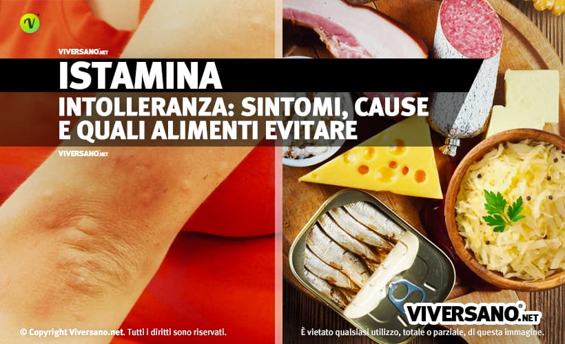 Alimenti con istamina e sintomi da intolleranza