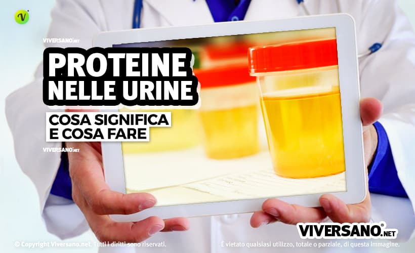 Proteine alte nelle urine