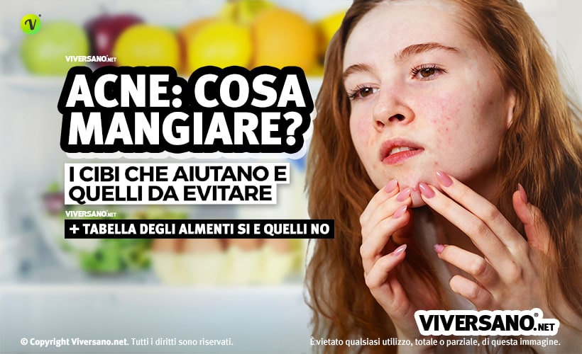 Donna con acne sul viso e alimenti sullo sfondo