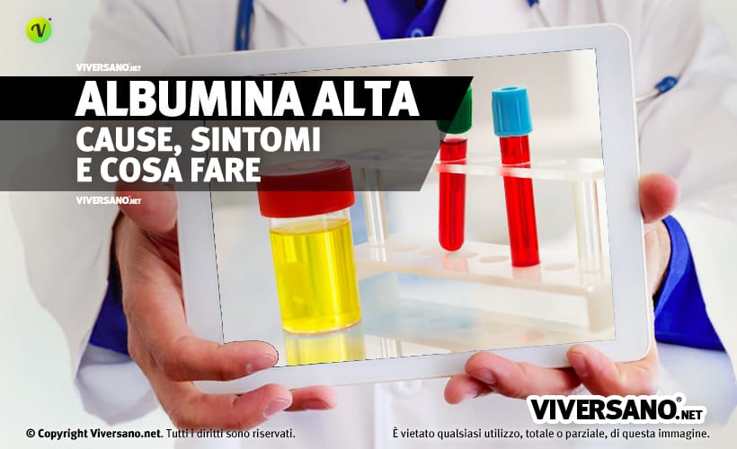 Albumina alta nel sangue o nelle urine